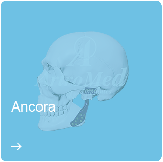 Ancora